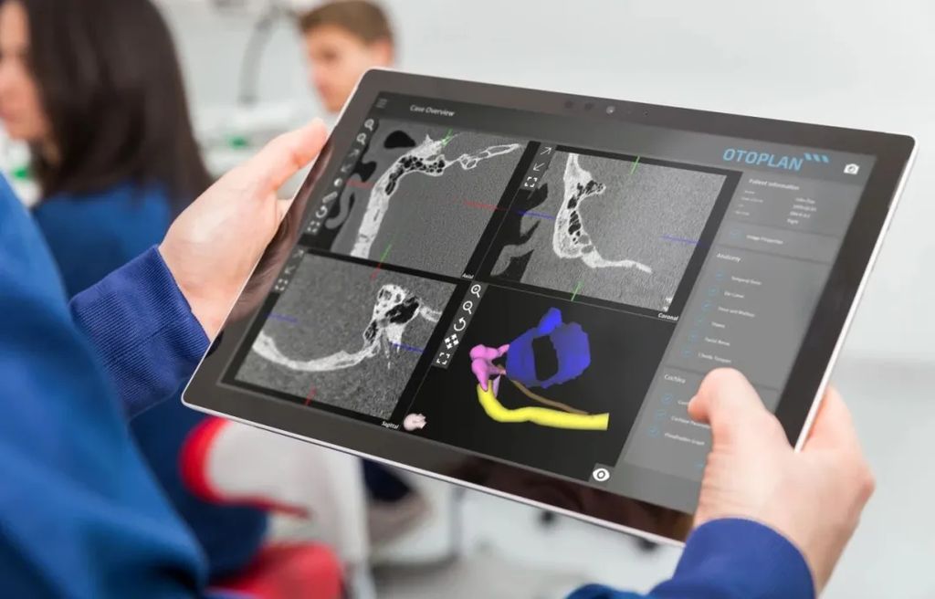 全球首個(gè):我國AI機(jī)器植入系統(tǒng)落地,精準(zhǔn)操刀人工耳蝸手術(shù)